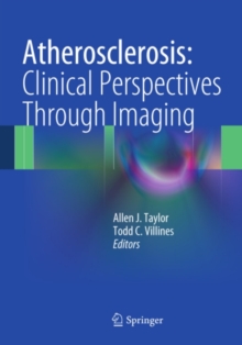 Atherosclerosis:  Clinical Perspectives Through Imaging