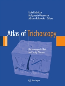 Atlas of Trichoscopy : Dermoscopy in Hair and Scalp Disease