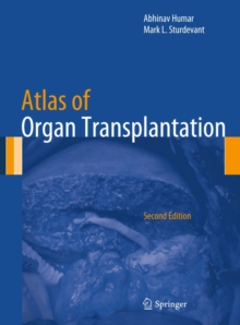 Atlas of Organ Transplantation