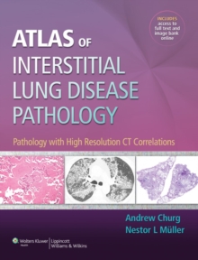Atlas of Interstitial Lung Disease Pathology : Pathology with High Resolution CT Correlations, Hardback Book Atlas of Interstitial Lung Disease Pathology : Pathology with High Resolution CT Correlations, Hardback Book