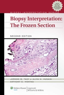 Biopsy Interpretation: The Frozen Section, Hardback Book Biopsy Interpretation: The Frozen Section, Hardback Book
