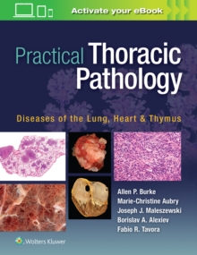 Practical Thoracic Pathology : Diseases of the Lung, Heart, and Thymus, Hardback Book Practical Thoracic Pathology : Diseases of the Lung, Heart, and Thymus, Hardback Book
