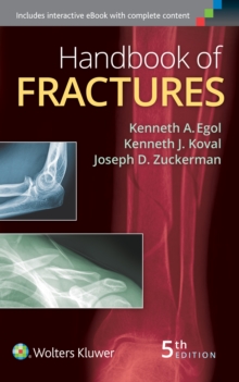 Handbook of Fractures, Paperback Book Handbook of Fractures, Paperback Book