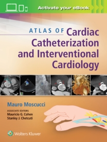 Atlas of Cardiac Catheterization and Interventional Cardiology, Hardback Book Atlas of Cardiac Catheterization and Interventional Cardiology, Hardback Book