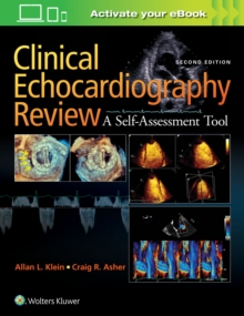 Clinical Echocardiography Review, Paperback / softback Book Clinical Echocardiography Review, Paperback / softback Book
