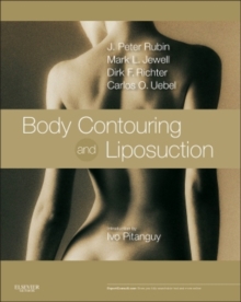 Body Contouring and Liposuction : Expert Consult - Online and Print, Hardback Book Body Contouring and Liposuction : Expert Consult - Online and Print, Hardback Book