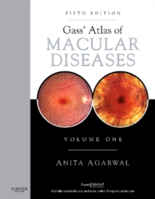 Gass' Atlas of Macular Diseases E-Book : 2-Volume Set - Expert Consult: Online and Print