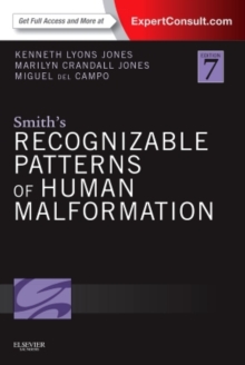 Smith's Recognizable Patterns of Human Malformation : Expert Consult - Online and Print, Hardback Book Smith's Recognizable Patterns of Human Malformation : Expert Consult - Online and Print, Hardback Book