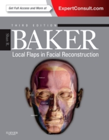 Local Flaps in Facial Reconstruction, Hardback Book Local Flaps in Facial Reconstruction, Hardback Book
