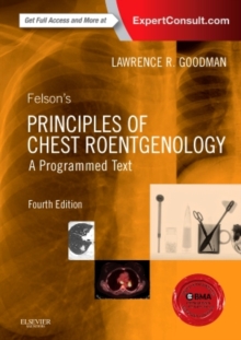Felson's Principles of Chest Roentgenology, A Programmed Text, Paperback Book Felson's Principles of Chest Roentgenology, A Programmed Text, Paperback Book