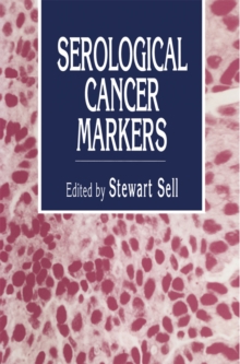 Serological Cancer Markers