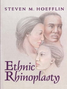 Ethnic Rhinoplasty