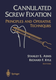 Cannulated Screw Fixation : Principles and Operative Techniques