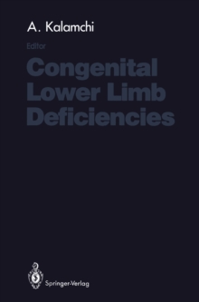 Congenital Lower Limb Deficiencies