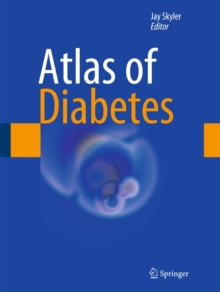 Atlas of Diabetes, Hardback Book Atlas of Diabetes, Hardback Book