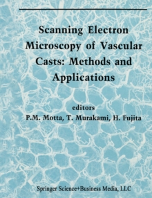 Scanning Electron Microscopy of Vascular Casts: Methods and Applications