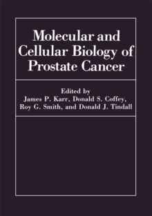 Molecular and Cellular Biology of Prostate Cancer