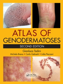 Atlas of Genodermatoses