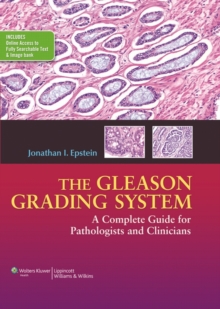 The Gleason Grading System : A Complete Guide for Pathologist and Clinicians