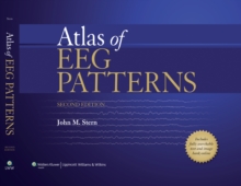 Atlas of EEG Patterns