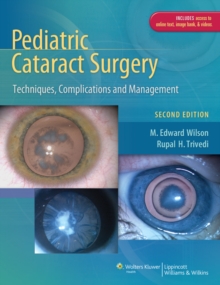 Pediatric Cataract Surgery : Techniques, Complications and Management