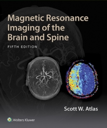 Magnetic Resonance Imaging of the Brain and Spine