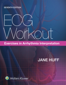 ECG Workout : Exercises in Arrhythmia Interpretation, Paperback Book ECG Workout : Exercises in Arrhythmia Interpretation, Paperback Book