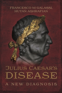 Julius Caesar's Disease : A New Diagnosis