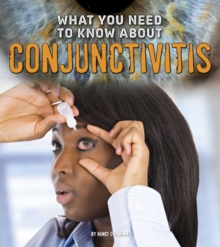 What You Need to Know about Conjunctivitis