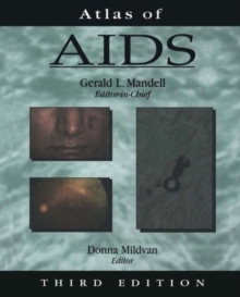 Atlas of AIDS