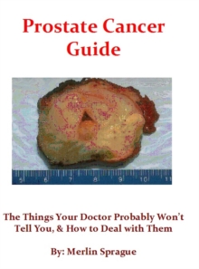 Prostate Cancer Guide, The Things Your Doctor Probably Won't Tell You, & How To Deal With Them