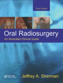 Oral Radiosurgery : An Illustrated Clinical Guide