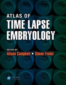 Atlas of Time Lapse Embryology, Mixed media product Book Atlas of Time Lapse Embryology, Mixed media product Book
