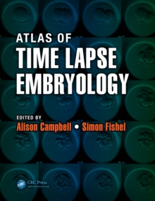 Atlas of Time Lapse Embryology