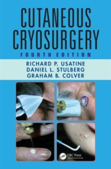 Cutaneous Cryosurgery, Fourth Edition, Hardback Book Cutaneous Cryosurgery, Fourth Edition, Hardback Book