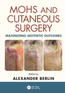 Mohs and Cutaneous Surgery : Maximizing Aesthetic Outcomes