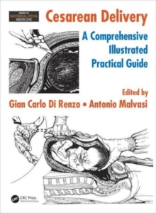 Cesarean Delivery : A Comprehensive Illustrated Practical Guide, Hardback Book Cesarean Delivery : A Comprehensive Illustrated Practical Guide, Hardback Book