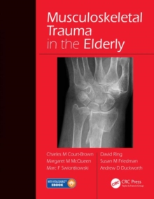 Musculoskeletal Trauma in the Elderly, Mixed media product Book Musculoskeletal Trauma in the Elderly, Mixed media product Book
