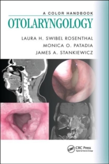 Otolaryngology : A Color Handbook, Paperback Book Otolaryngology : A Color Handbook, Paperback Book