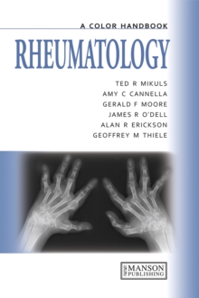 Rheumatology : A Color Handbook