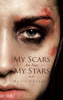 My Scars Are Now My Stars