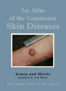 An Atlas of the Commoner Skin Diseases : With 153 Plates Reproduced by Direct Colour Photography from the Living Subject