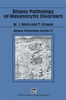 Biopsy Pathology of Melanocytic Disorders