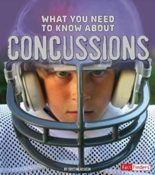 What You Need to Know about Concussions, Paperback / softback Book What You Need to Know about Concussions, Paperback / softback Book