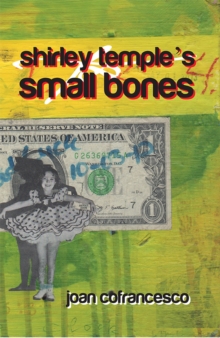 Shirley Temple'S Small Bones