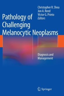 Pathology of Challenging Melanocytic Neoplasms : Diagnosis and Management, Hardback Book Pathology of Challenging Melanocytic Neoplasms : Diagnosis and Management, Hardback Book
