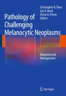 Pathology of Challenging Melanocytic Neoplasms : Diagnosis and Management