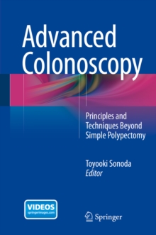 Advanced Colonoscopy : Principles and Techniques Beyond Simple Polypectomy