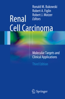 Renal Cell Carcinoma : Molecular Targets and Clinical Applications