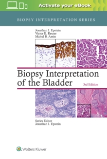 Biopsy Interpretation of the Bladder, Hardback Book Biopsy Interpretation of the Bladder, Hardback Book